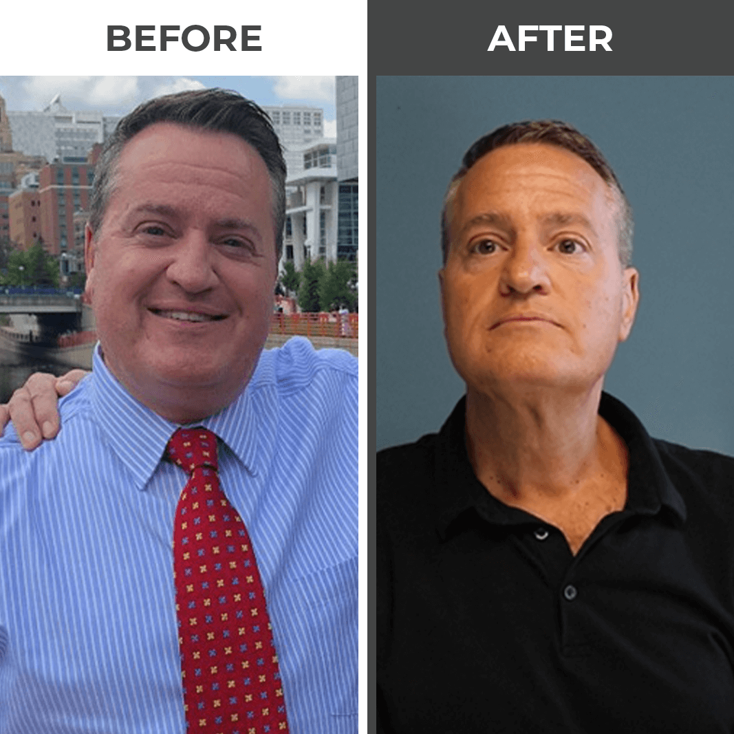 Before and After 5